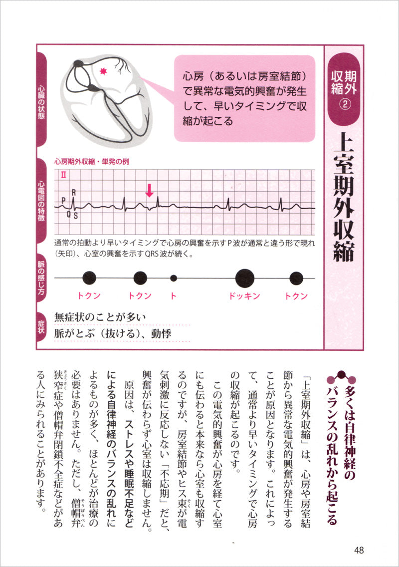 これで安心！不整脈〜脳梗塞・突然死を防ぐ