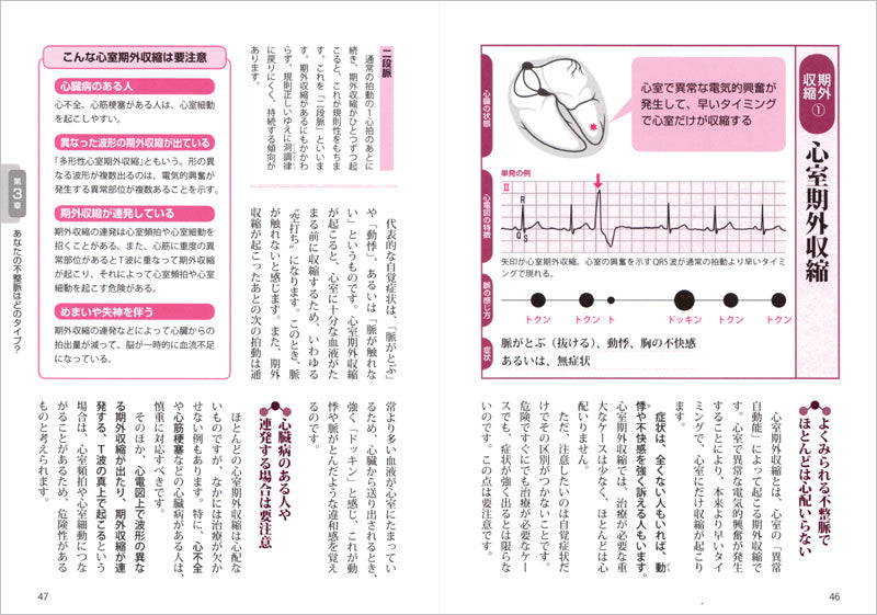 これで安心！不整脈〜脳梗塞・突然死を防ぐ