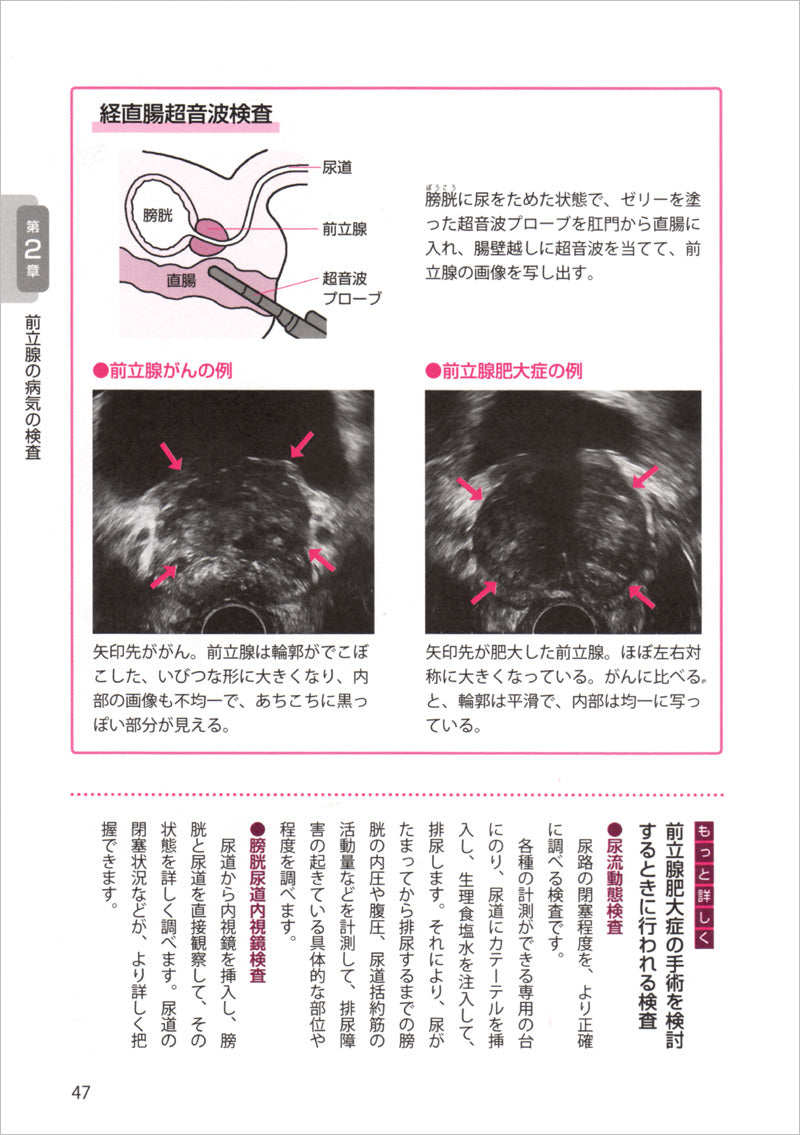 これで安心！前立腺がん・前立腺肥大症〜自分に合った治療法を選ぶ