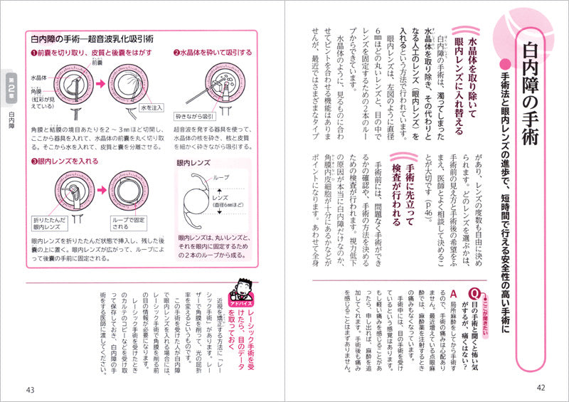 これで安心！中高年の目の病気〜白内障・緑内障・加齢黄斑変性など